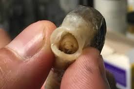 Parasites
