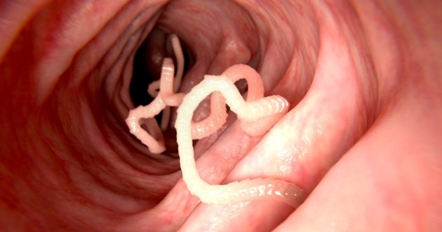 Parasites