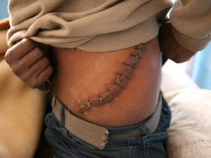 Organ stealing is rampant in parts of the Middle East