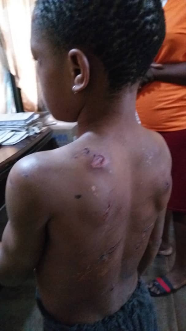 ABUSE: Police Nab A Man For Physically Assaulting His 9Yrs Old Niece